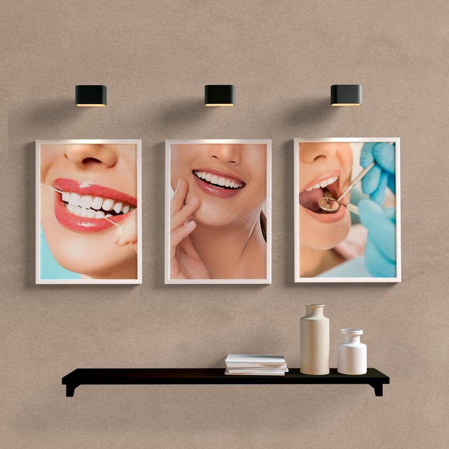 Kit Quadros Decorativos Dentista - detalhe da moldura e acabamento